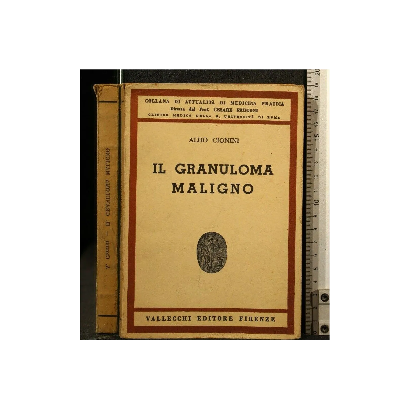 IL GRANULOMA MALIGNO