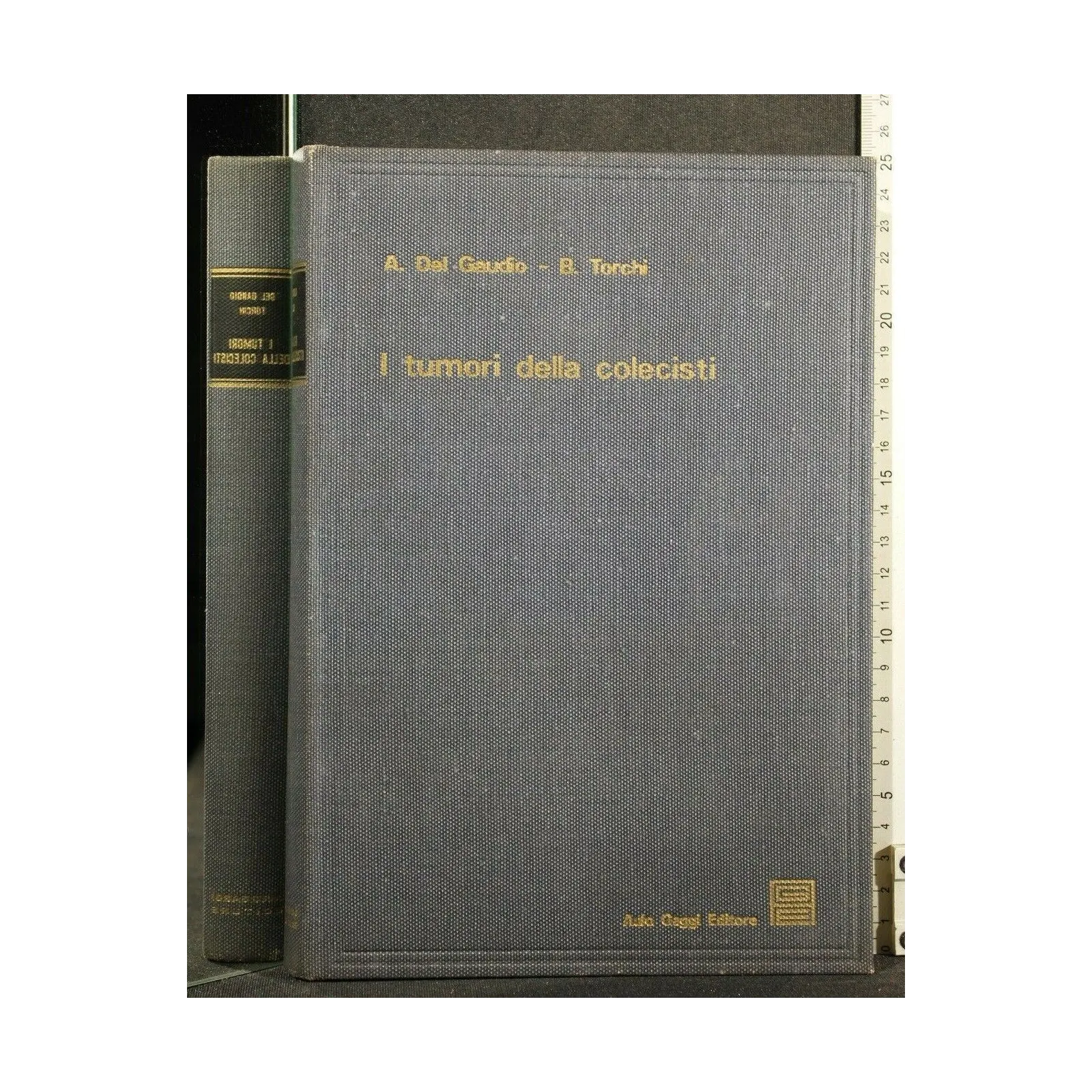 I TUMORI DELLA COLECISTI