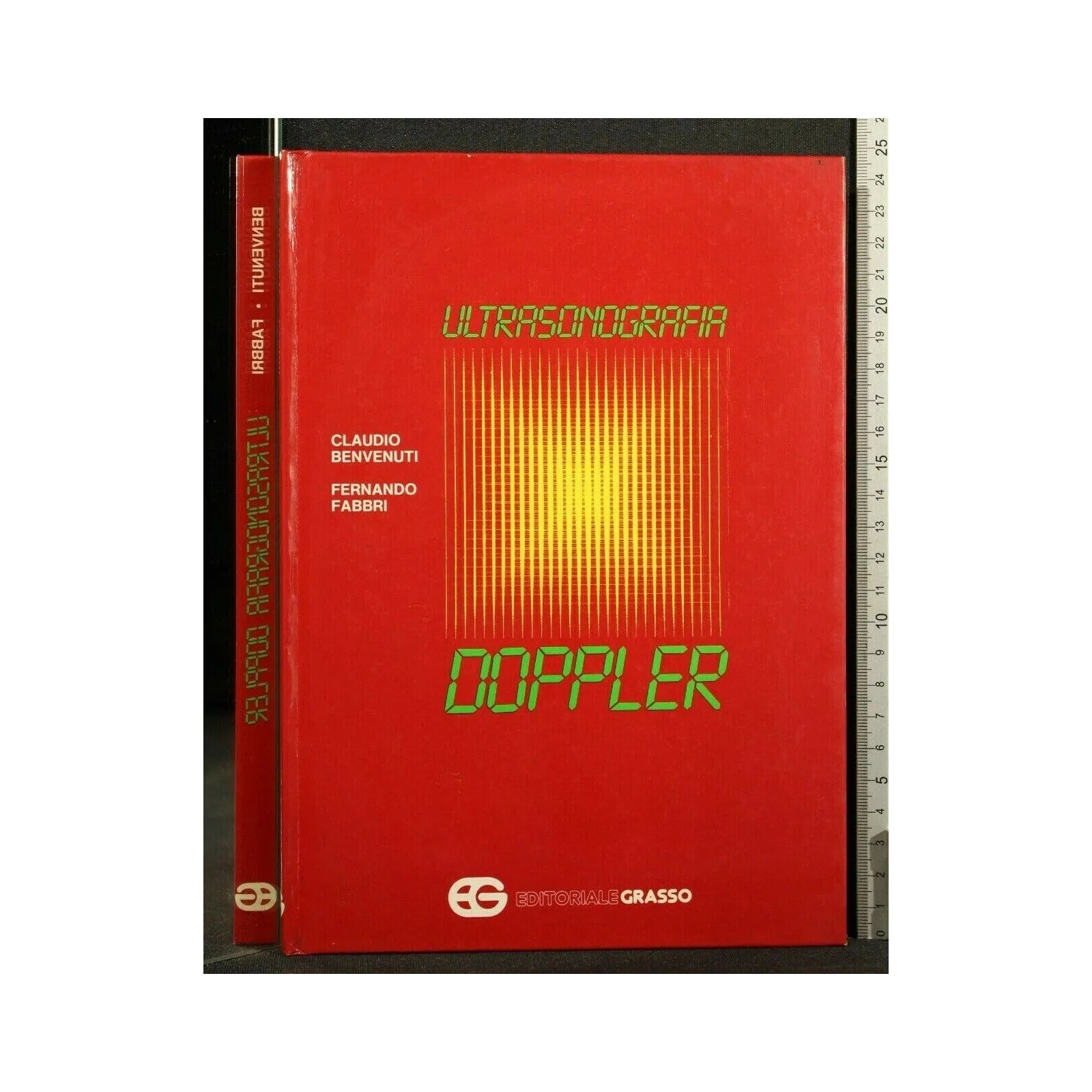 ULTRASONOGRAFIA DOPPLER