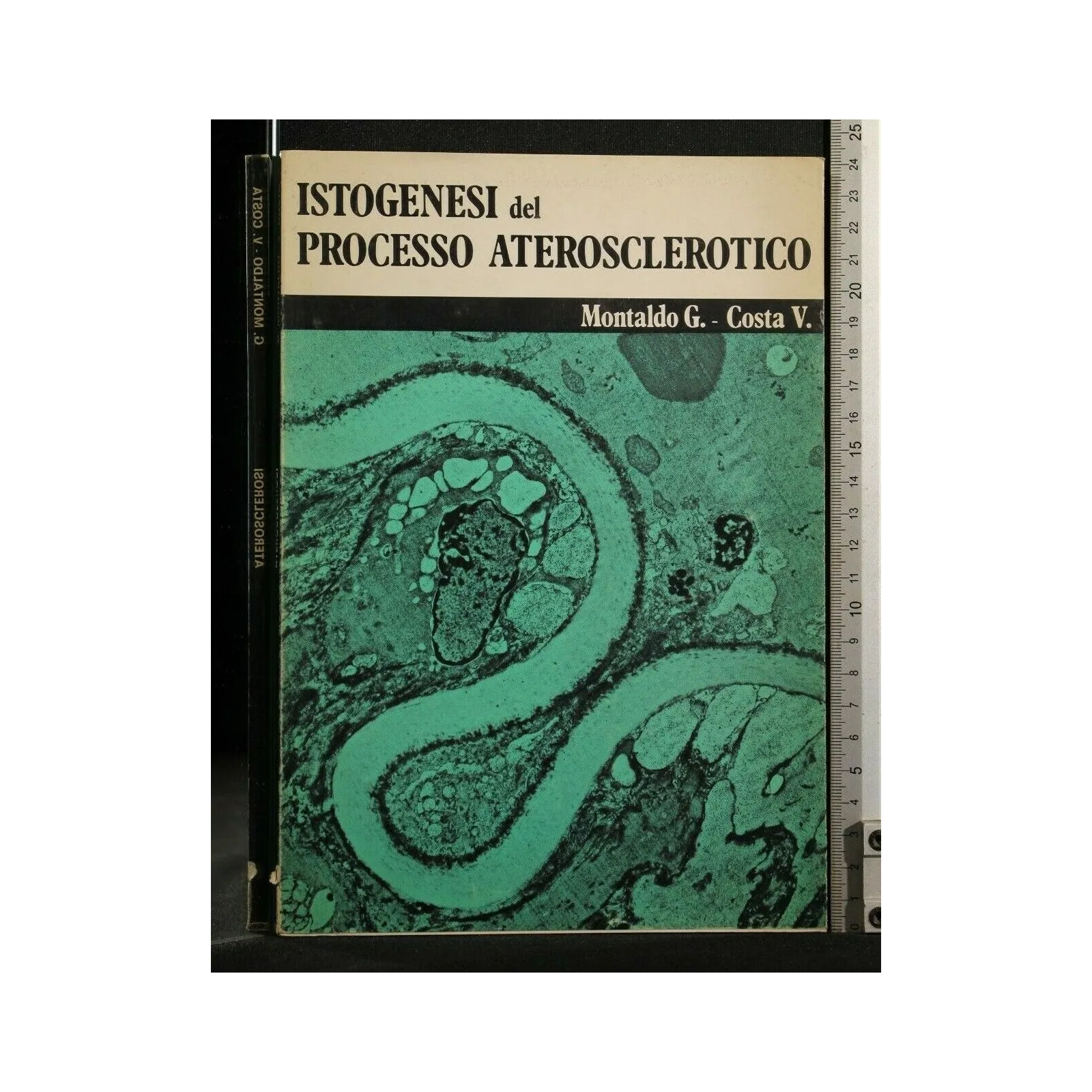 ISTOGENESI DEL PROCESSO ATEROSCLEROTICO