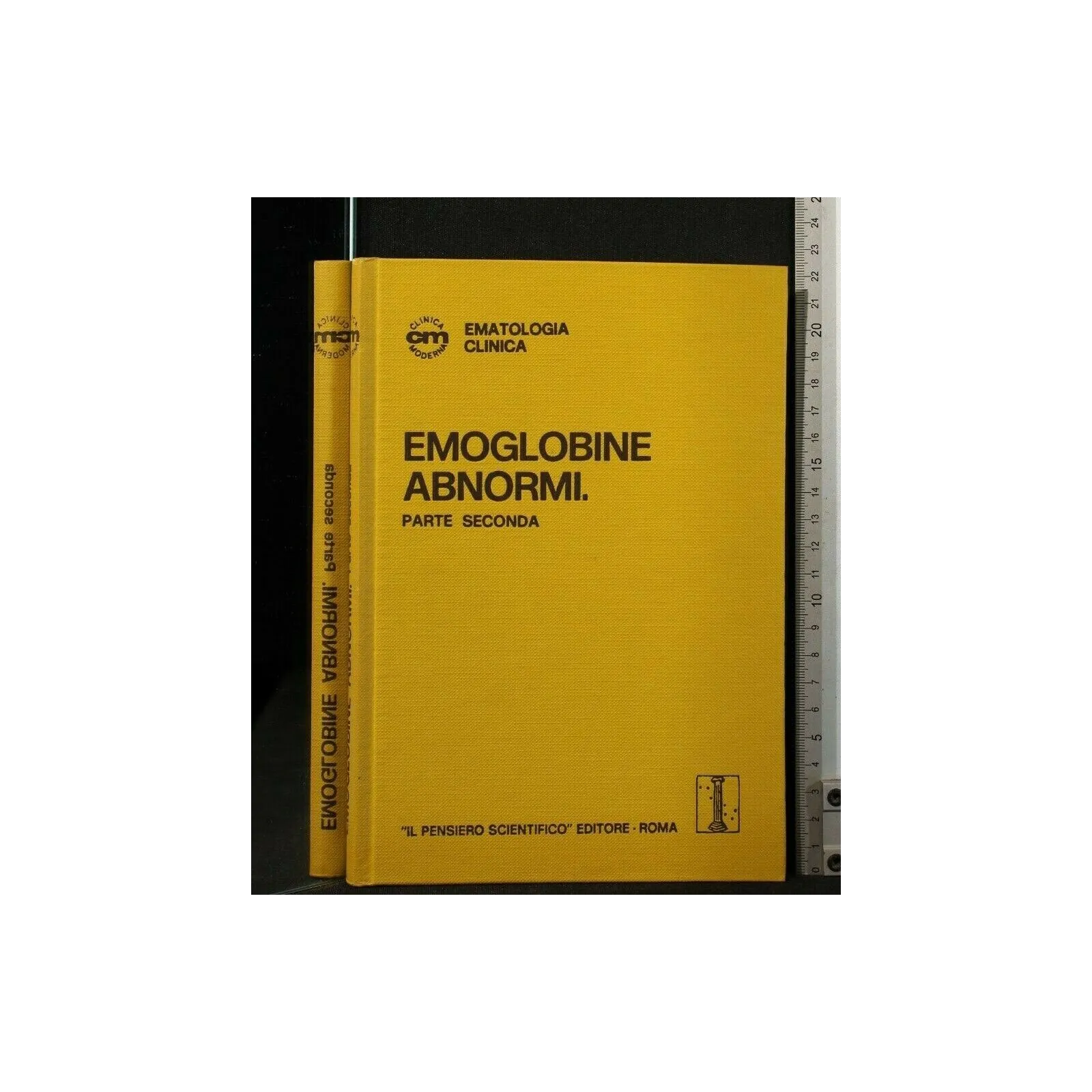 EMOGLOBINE ABNORMI 2 VOLUMI