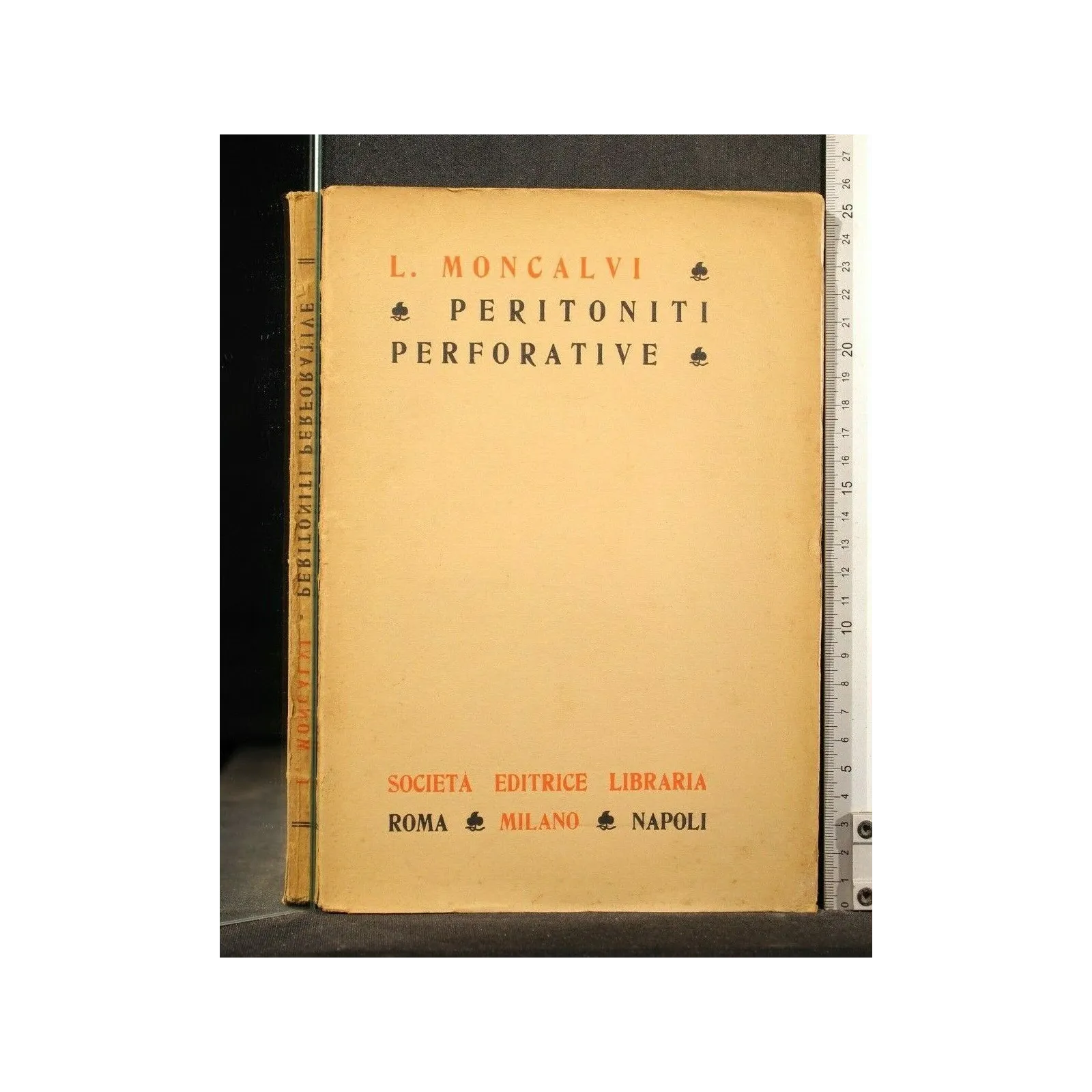 PERITONITI PERFORATIVE