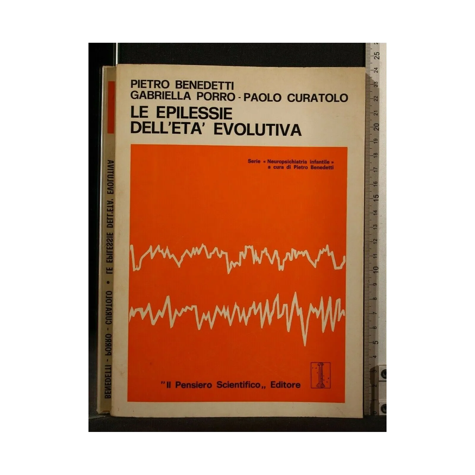 LE EPILESSIE DELL'ETA' EVOLUTIVA