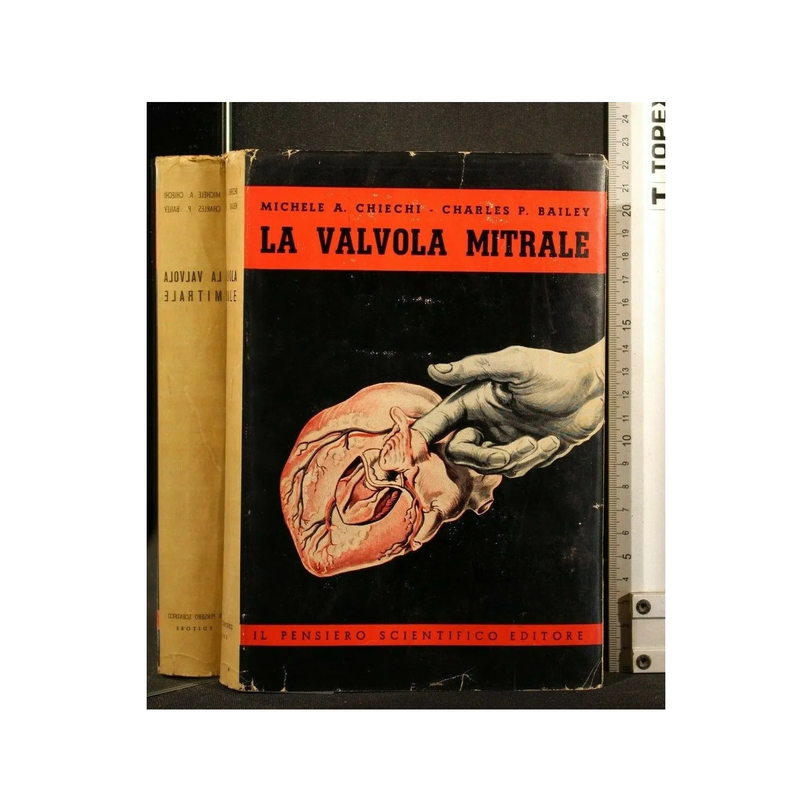 LA VALVOLA MITRALE