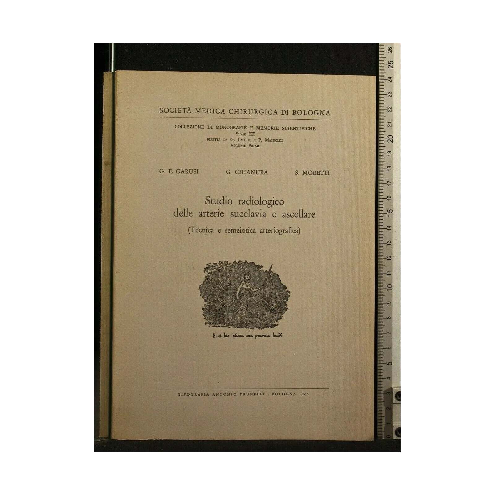 STUDIO RADIOLOGICO DELLE ARTERIE SUCCLAVIA E ASCELLARE