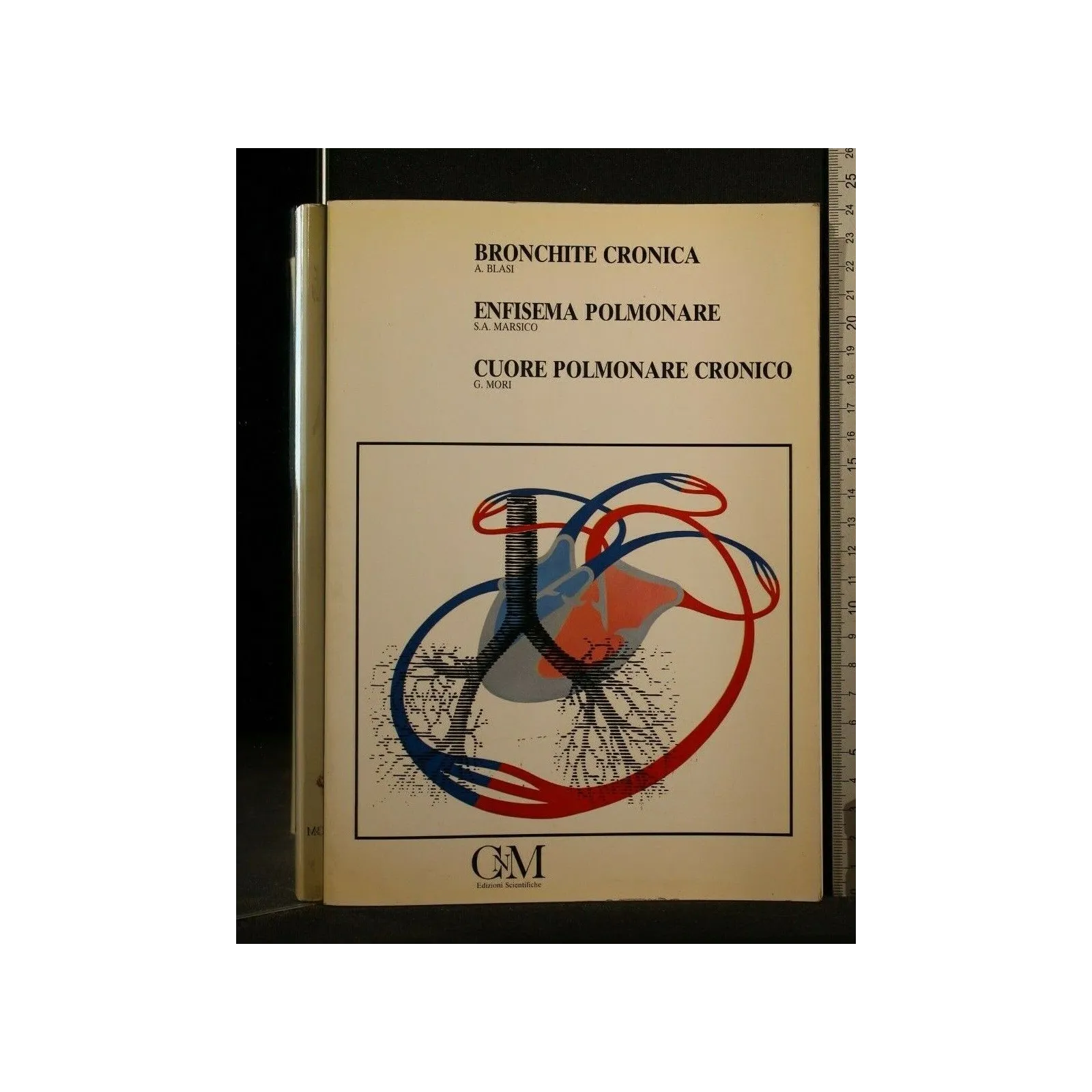 BRONCHITE CRONICA ENFISEMA POLMONARE CUORE POLMONARE CRONICO