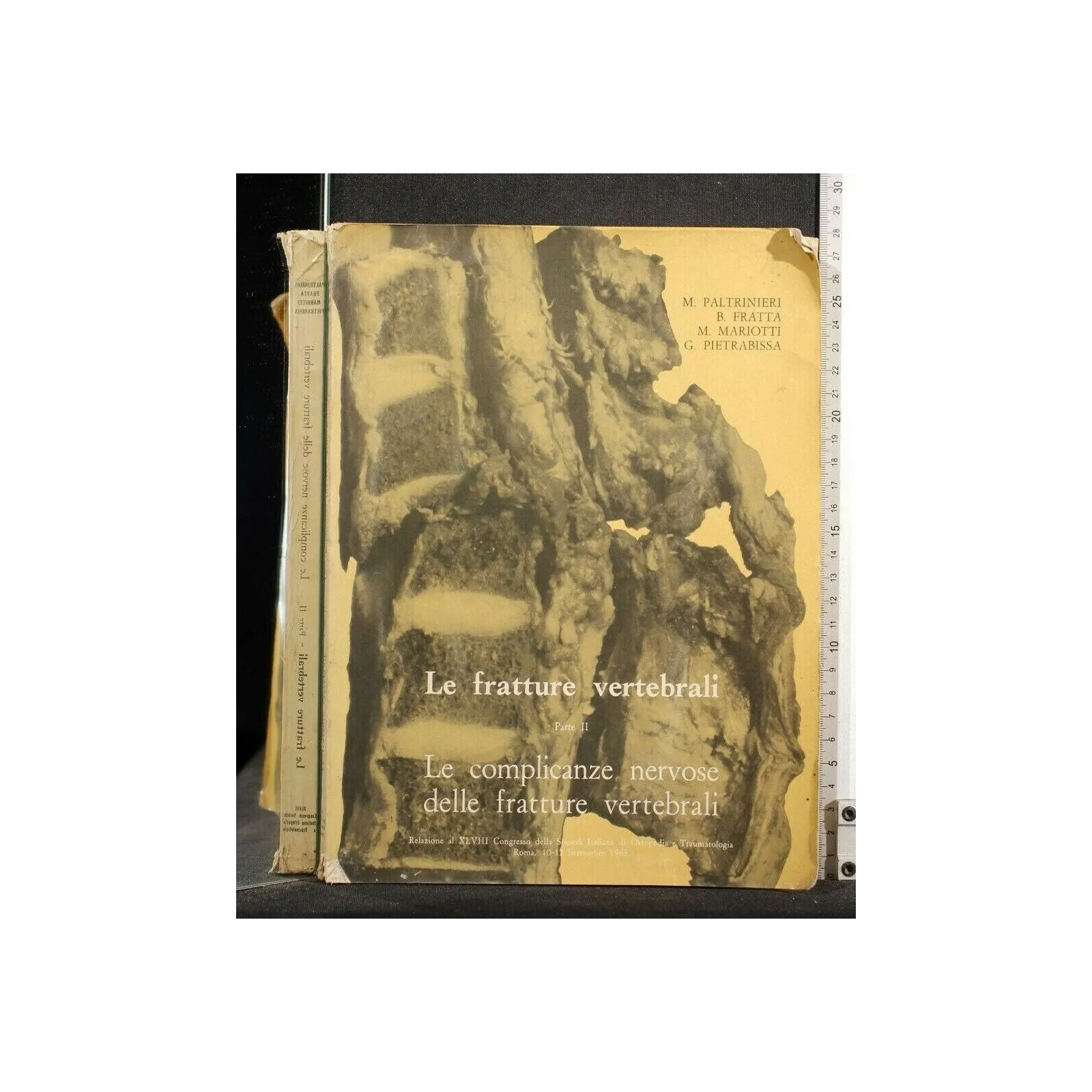 LE FRATTURE VERTEBRALI PARTE II LE COMPLICANZE NERVOSE DELLE