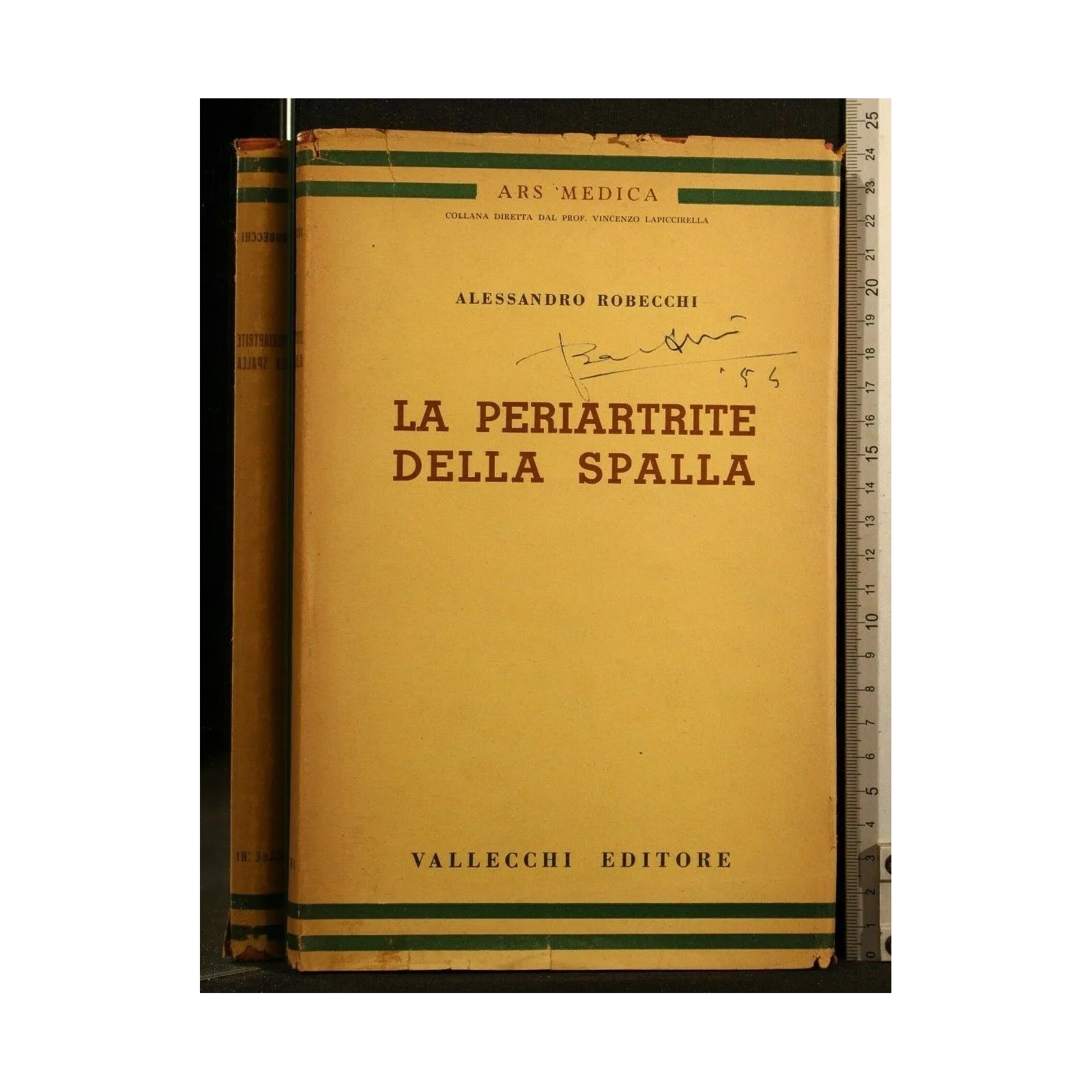 LA PERIARTRITE DELLA SPALLA