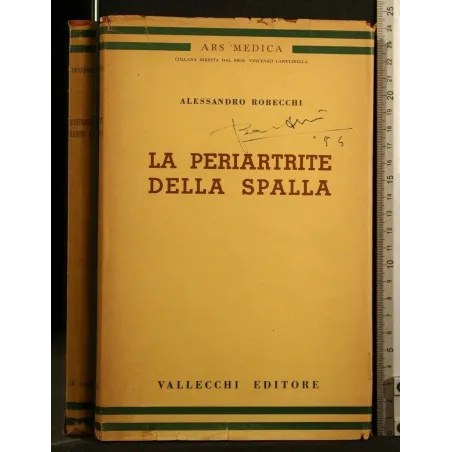 LA PERIARTRITE DELLA SPALLA