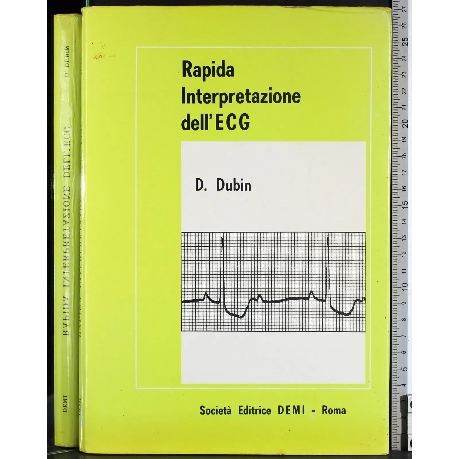 Rapida interpretazione dell'ECG