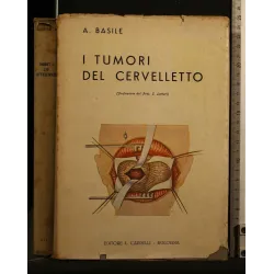 I TUMORI DEL CERVELLETTO