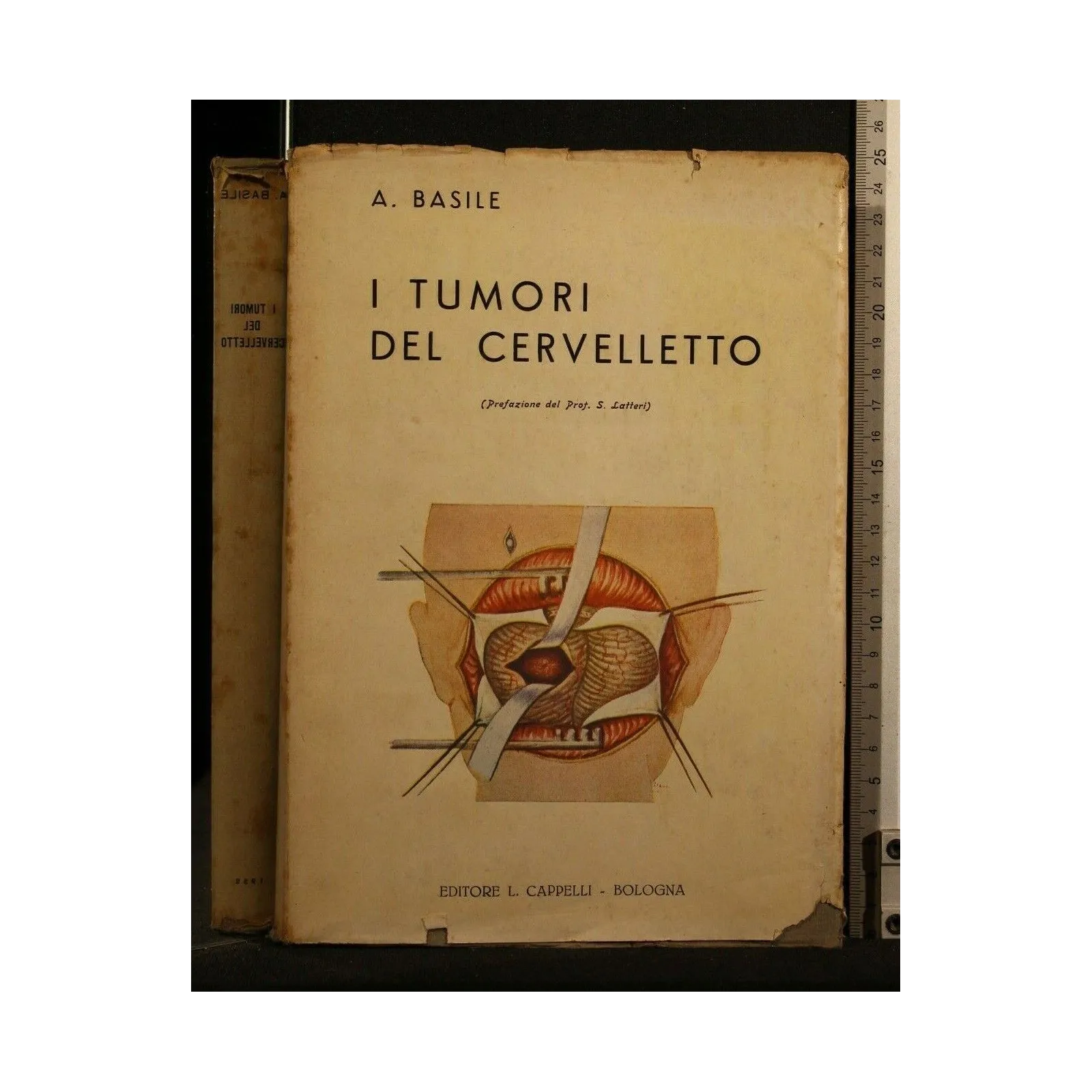 I TUMORI DEL CERVELLETTO