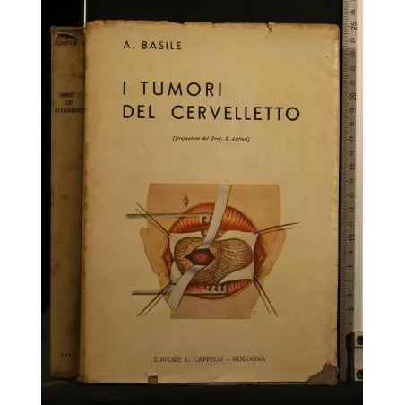 I TUMORI DEL CERVELLETTO