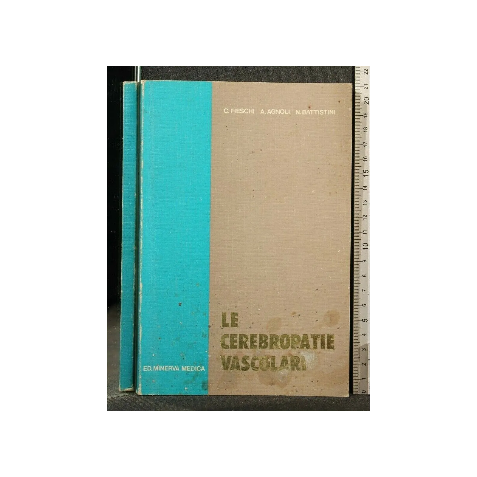 LE CEREBROPATIE VASCOLARI