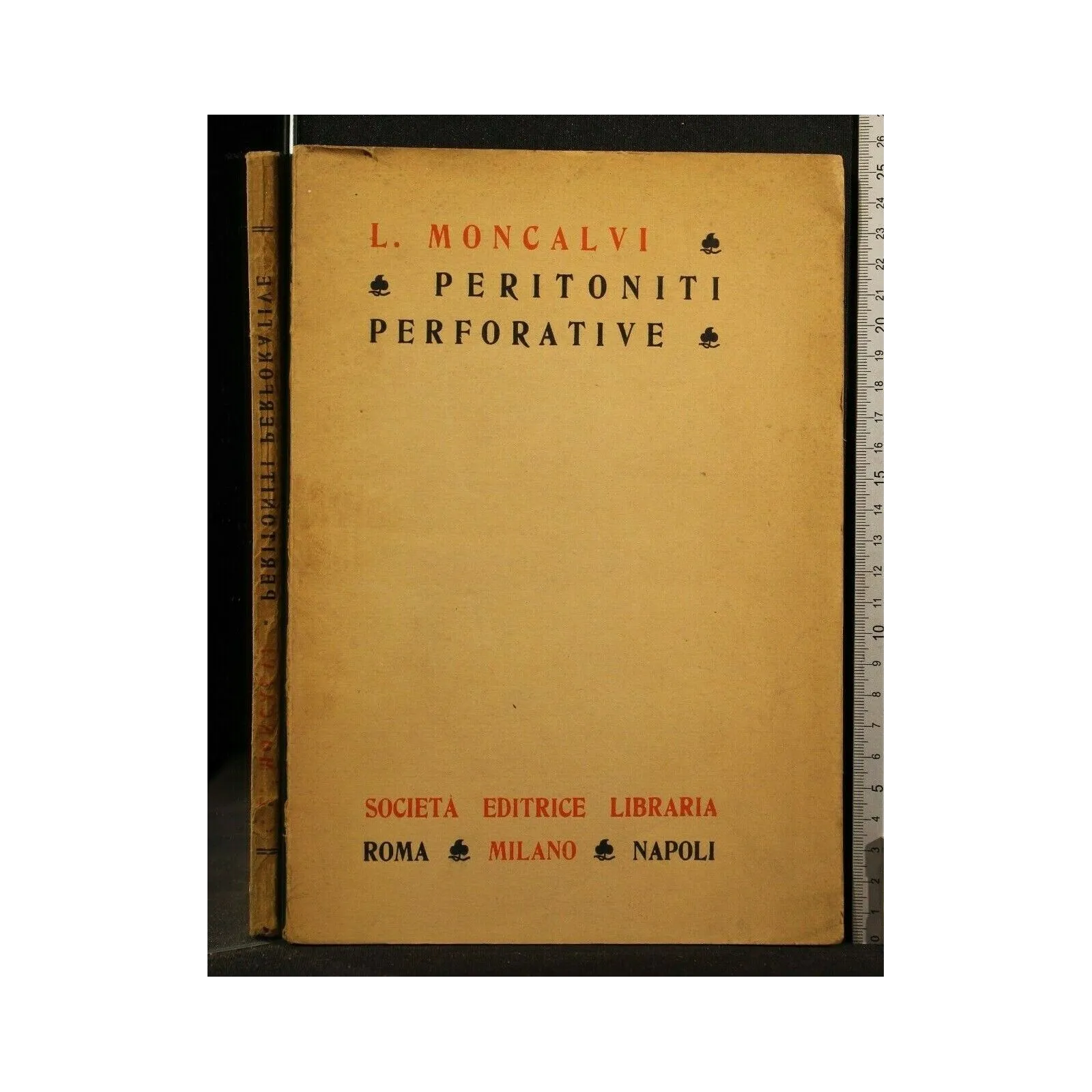 PERITONITI PERFORATIVE