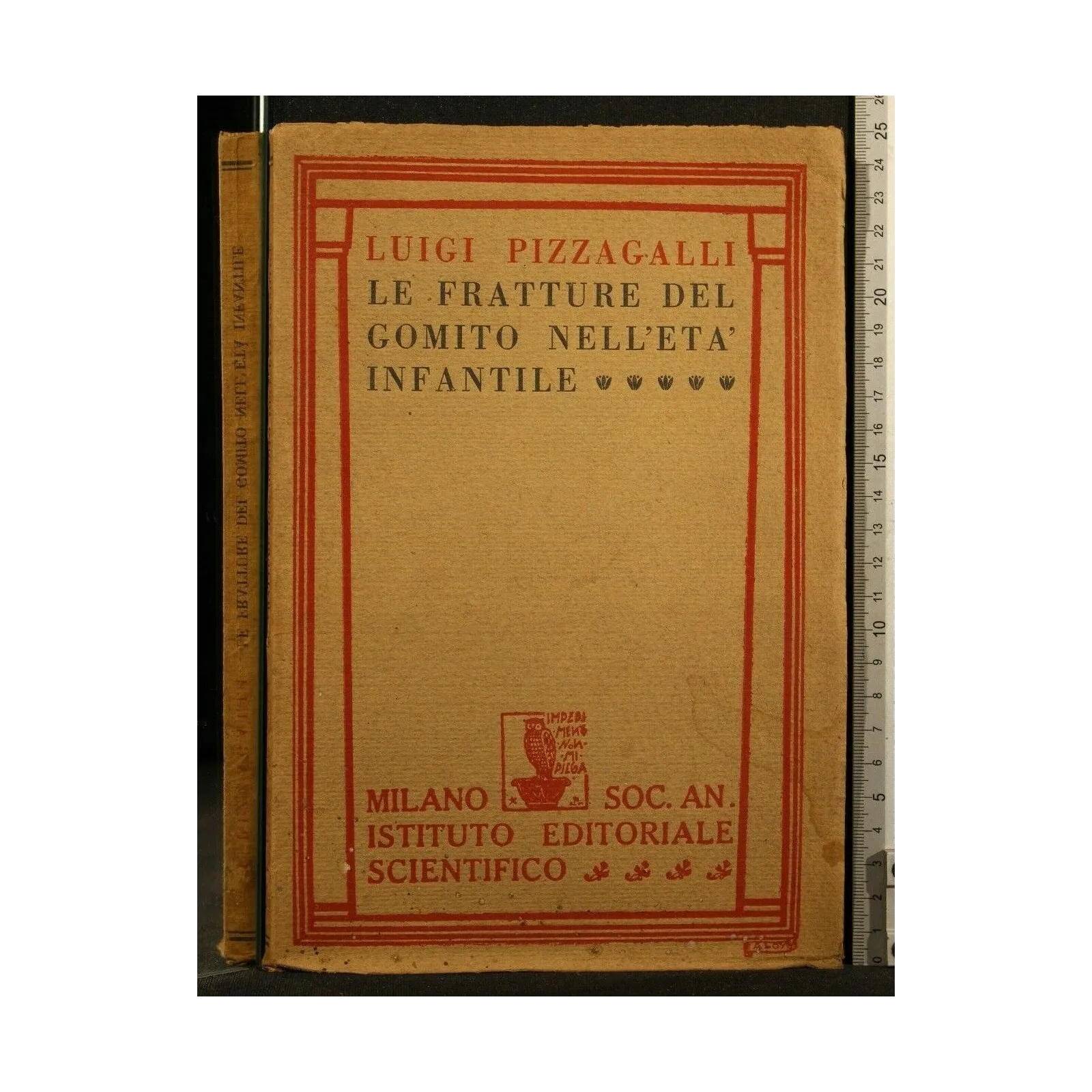LE FRATTURE DEL GOMITO NELL'ETA' INFANTILE