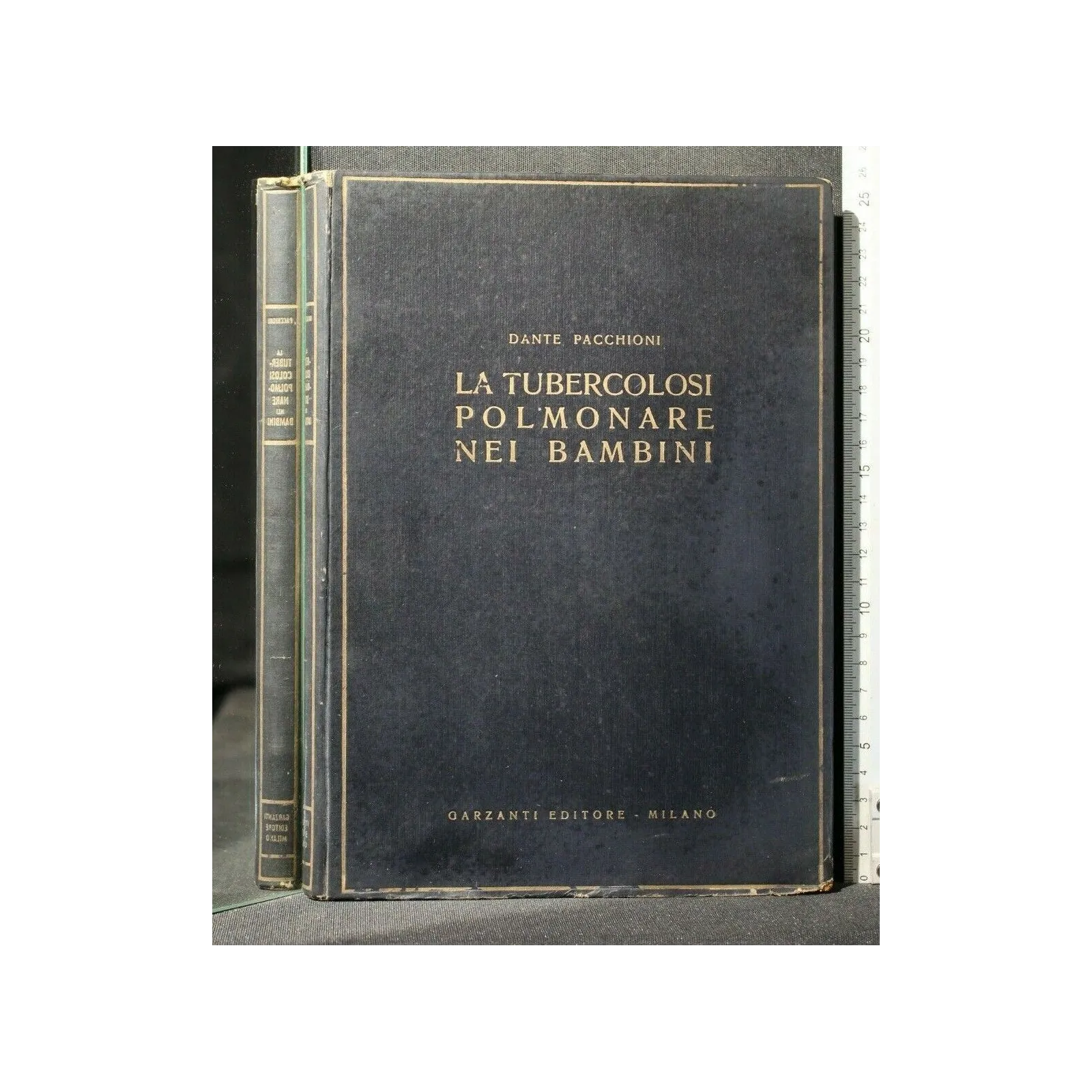 LA TUBERCOLOSI POLMONARE NEI BAMBINI