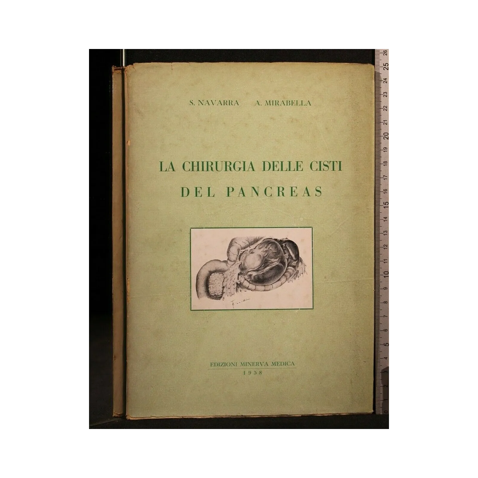 LA CHIRURGIA DELLE CISTI DEL PANCREAS