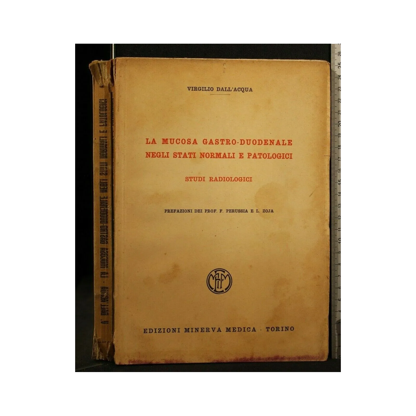 LA MUCOSA GASTRO-DUODENALE NEGLI STATI NORMALI E PATOLOGICI