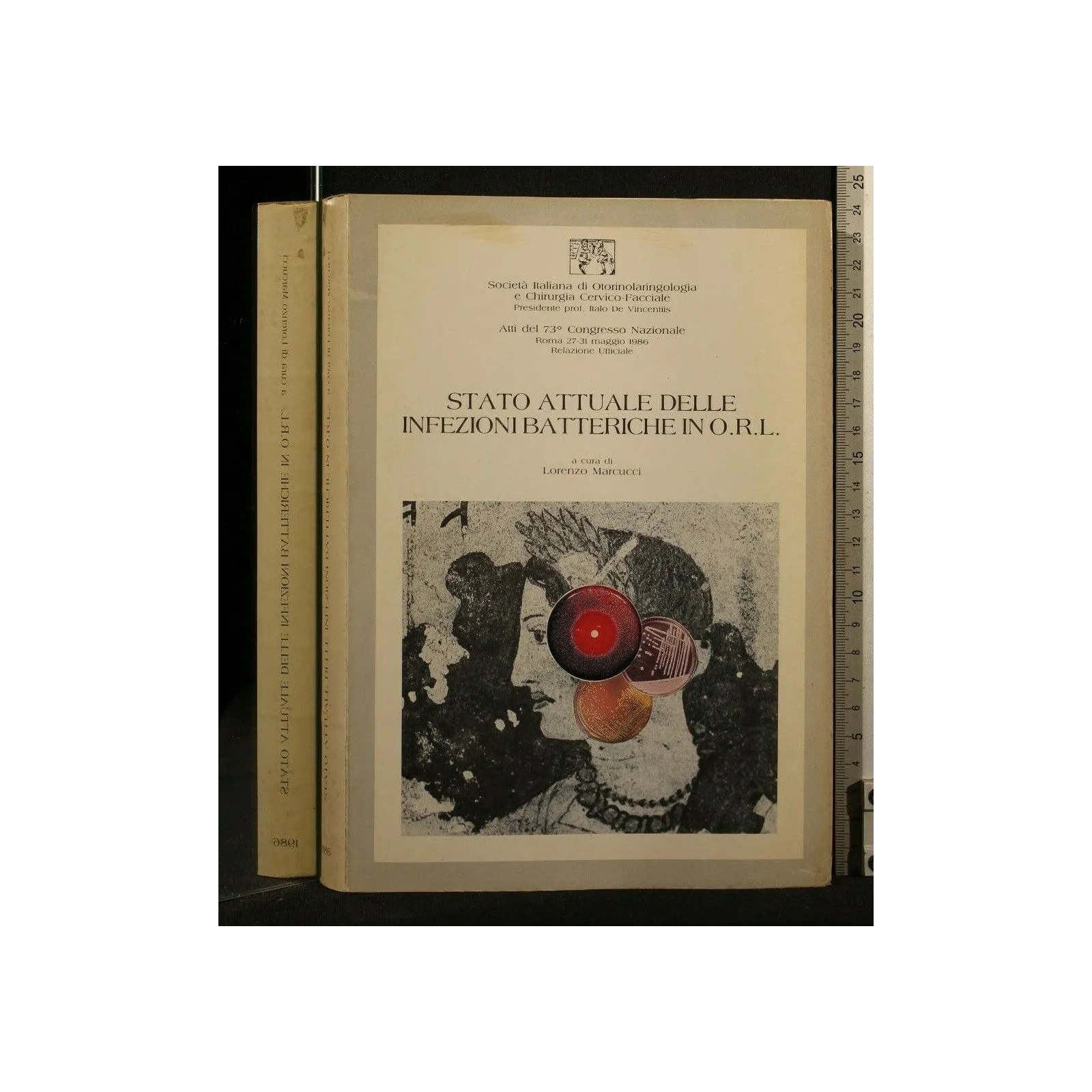 STATO ATTUALE DELLE INFEZIONI BATTERICHE IN O.R.L.
