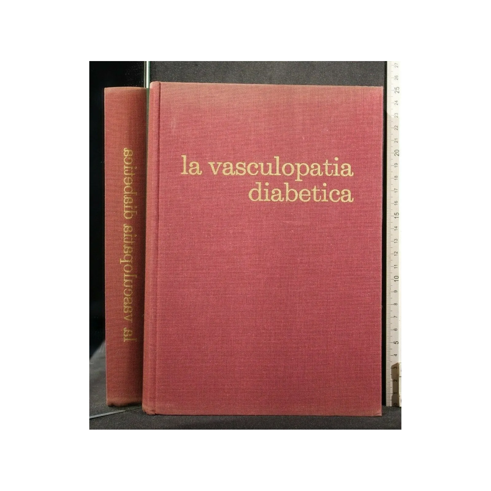 LA VASCULOPATIA DIABETICA