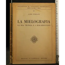 LA MIELOGRAFIA LA SUA TECNICA E I SUOI RISULTATI