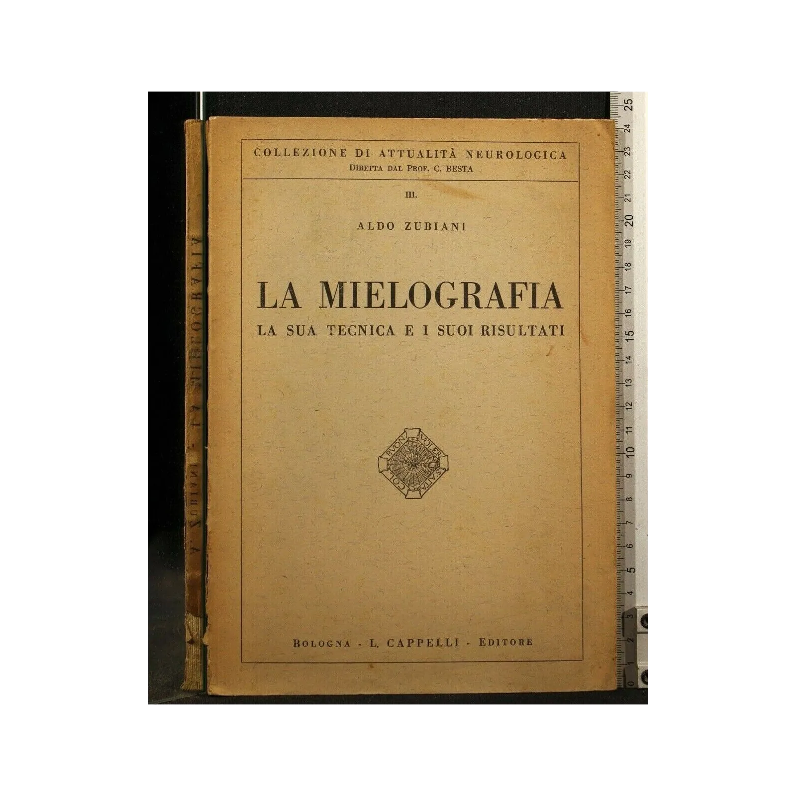 LA MIELOGRAFIA LA SUA TECNICA E I SUOI RISULTATI