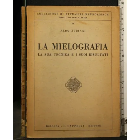 LA MIELOGRAFIA LA SUA TECNICA E I SUOI RISULTATI