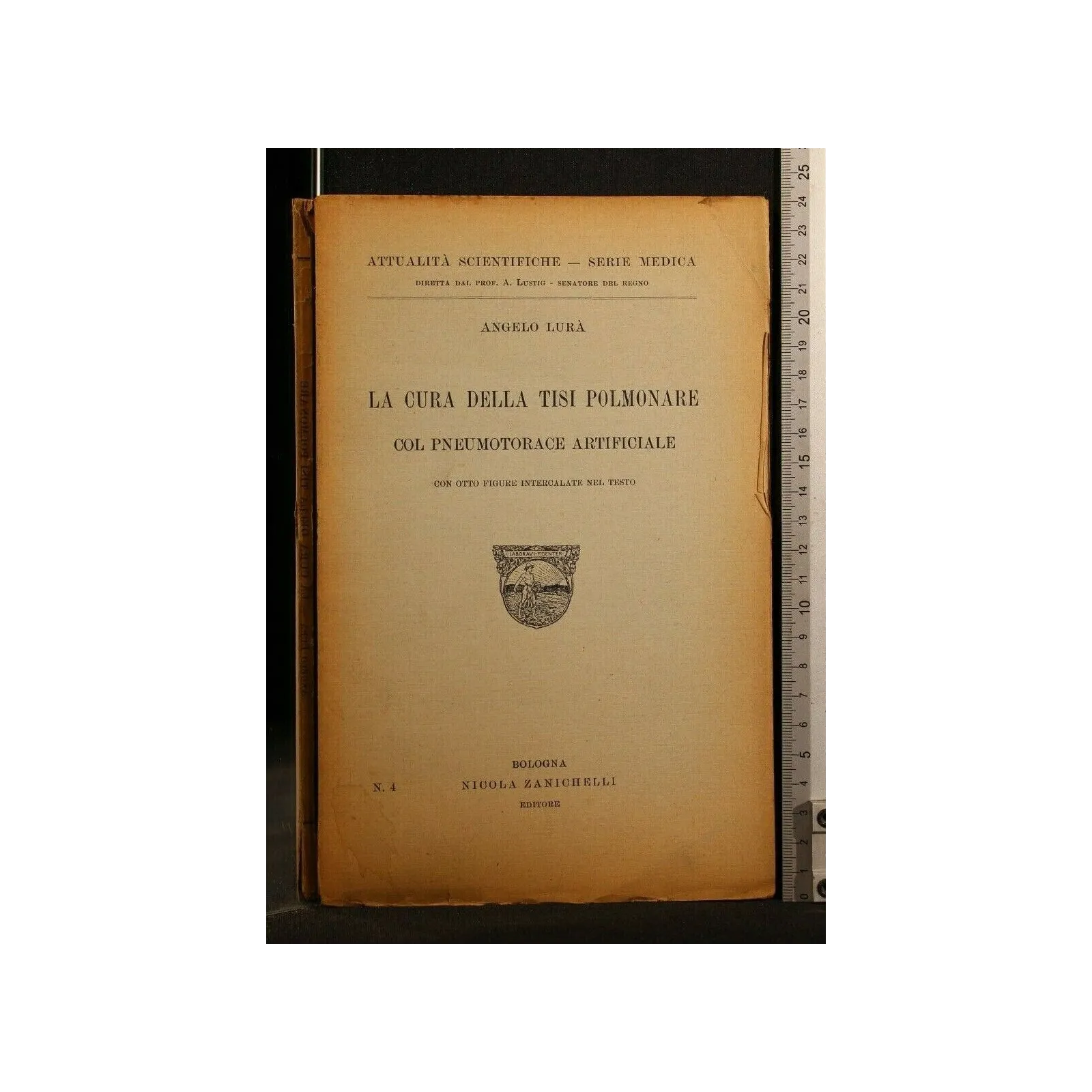 LA CURA DELLA TISI POLMONARE COL PNEUMOTORACE ARTIFICIALE