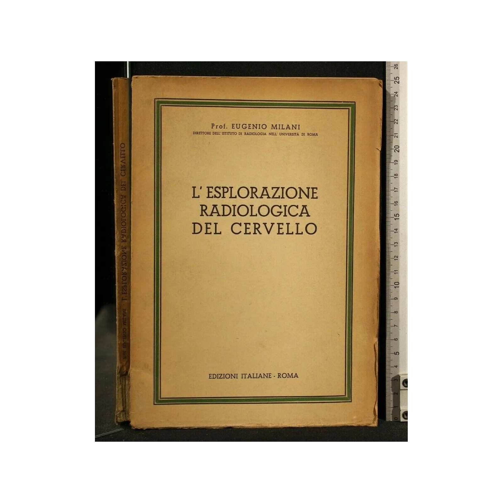 L'ESPLORAZIONE RADIOLOGICA DEL CERVELLO