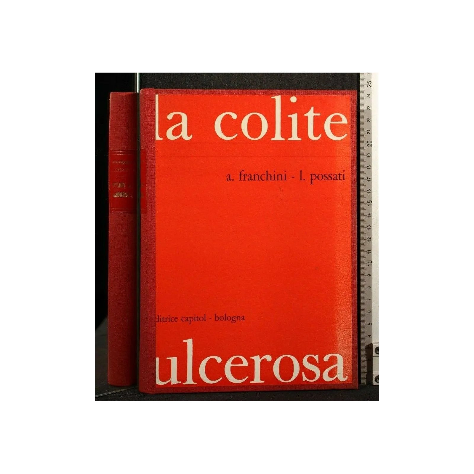 LA COLITE ULCEROSA