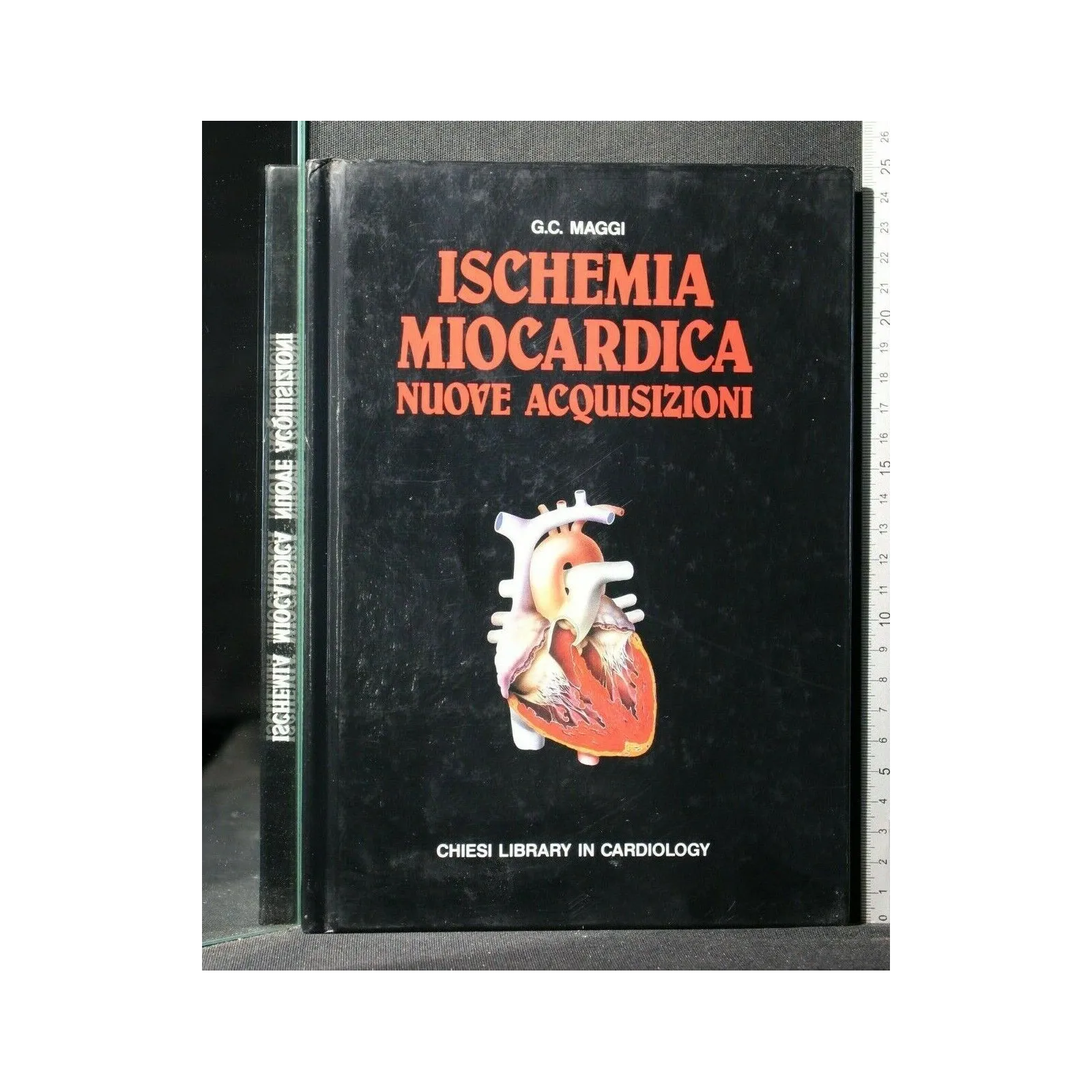 ISCHEMIA MIOCARDICA NUOVE ACQUISIZIONI