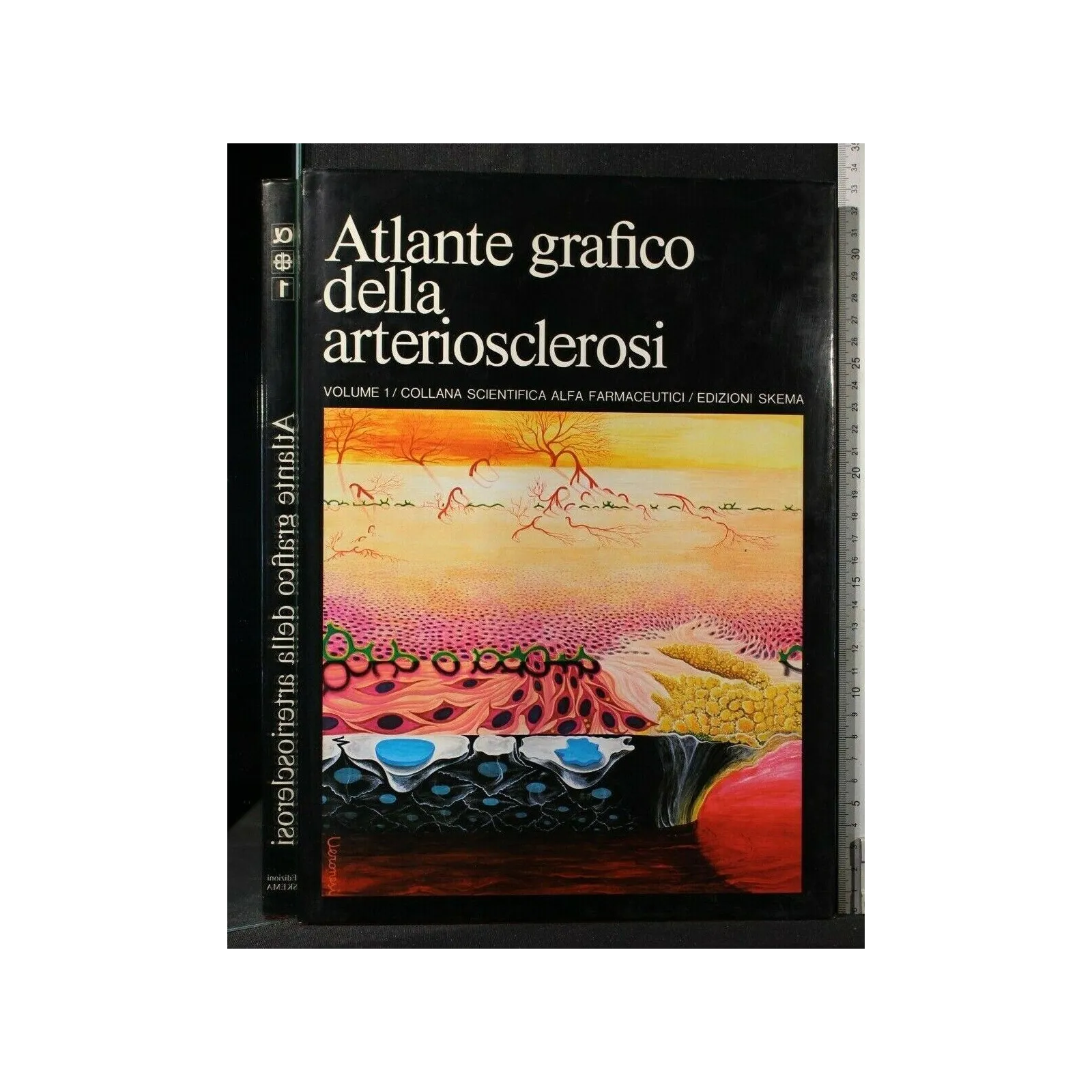 ATLANTE GRAFICO DELLA ARTERIOSCLEROSI VOL.1-2