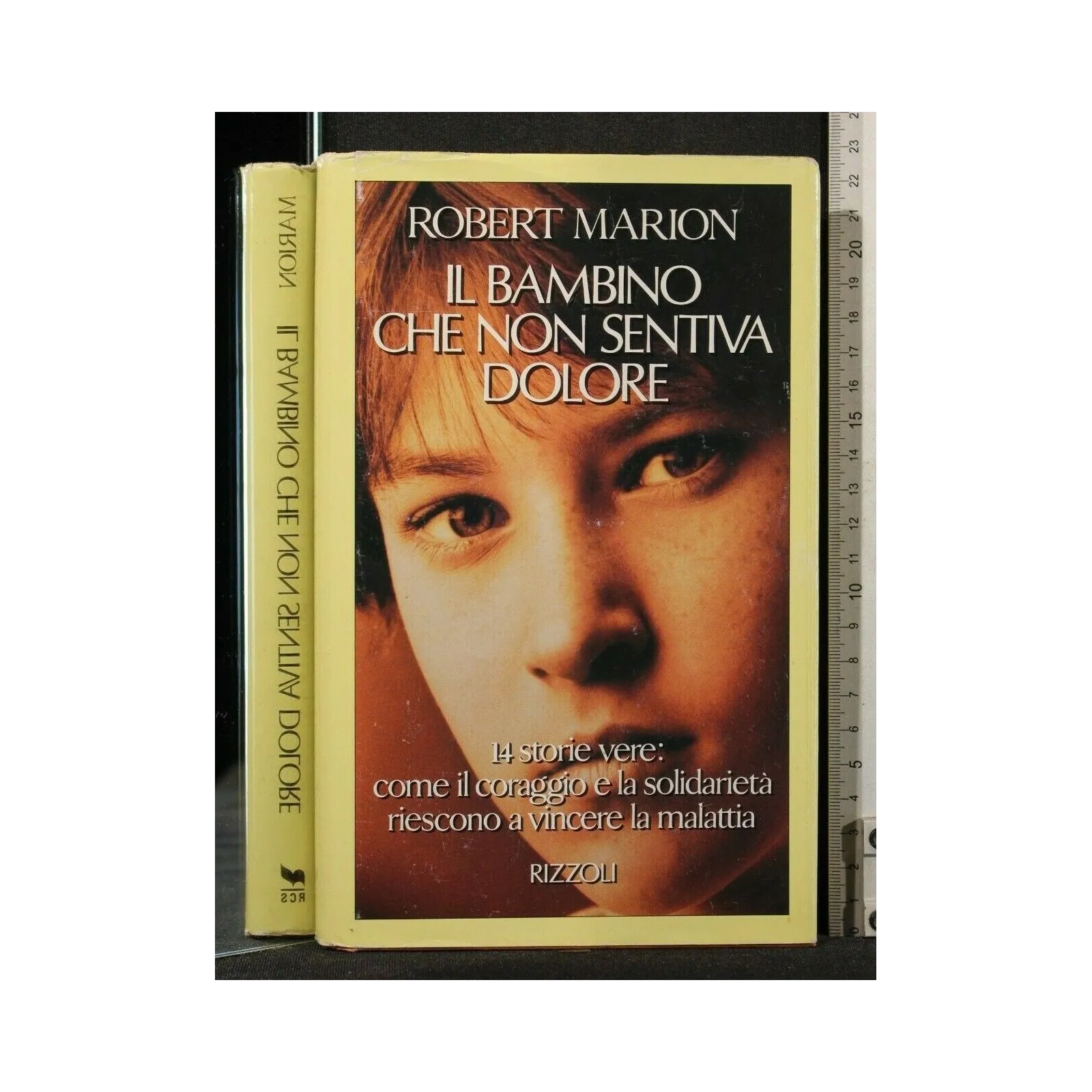 IL BAMBINO CHE NON SENTIVA DOLORE