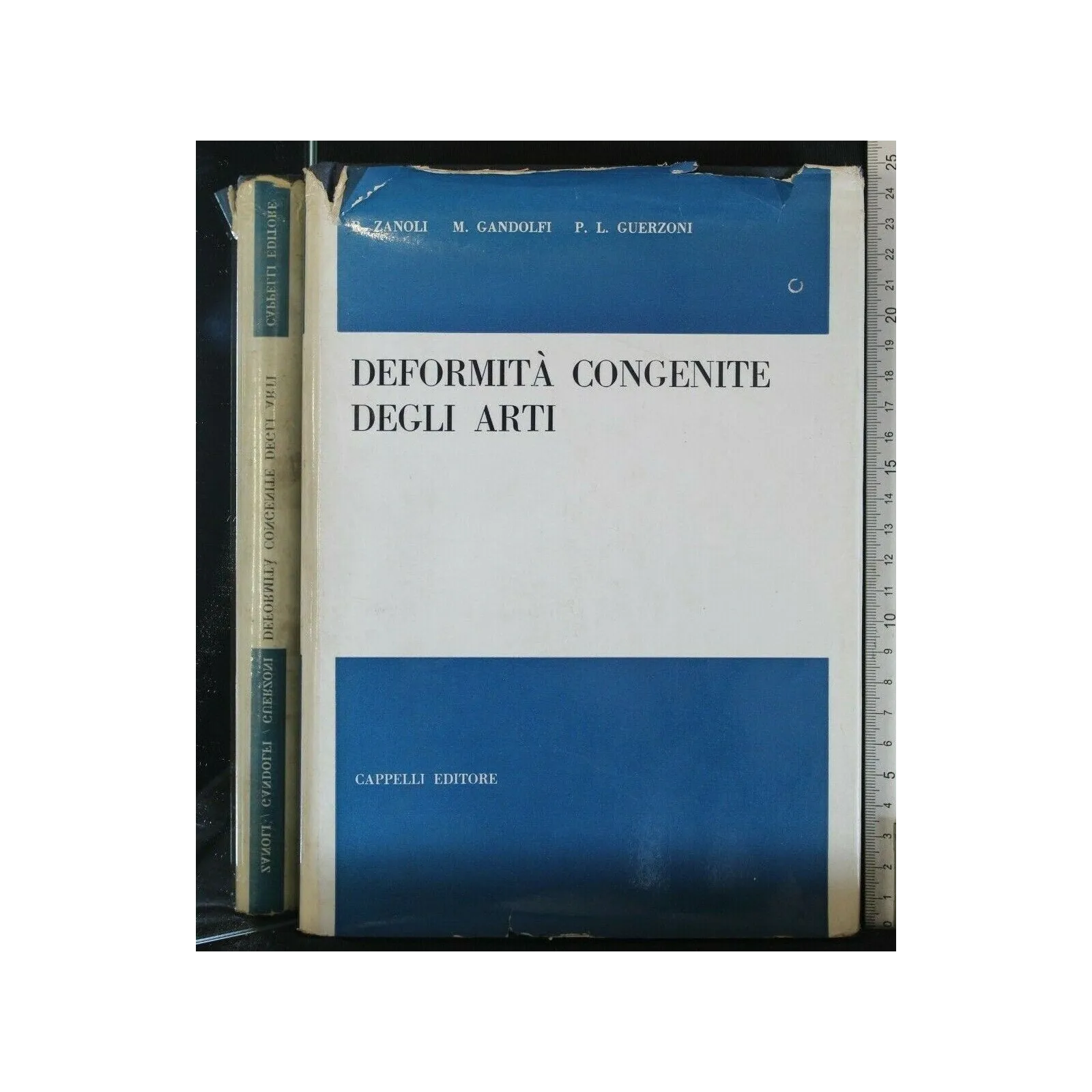 DEFORMITA' CONGENITE DEGLI ARTI