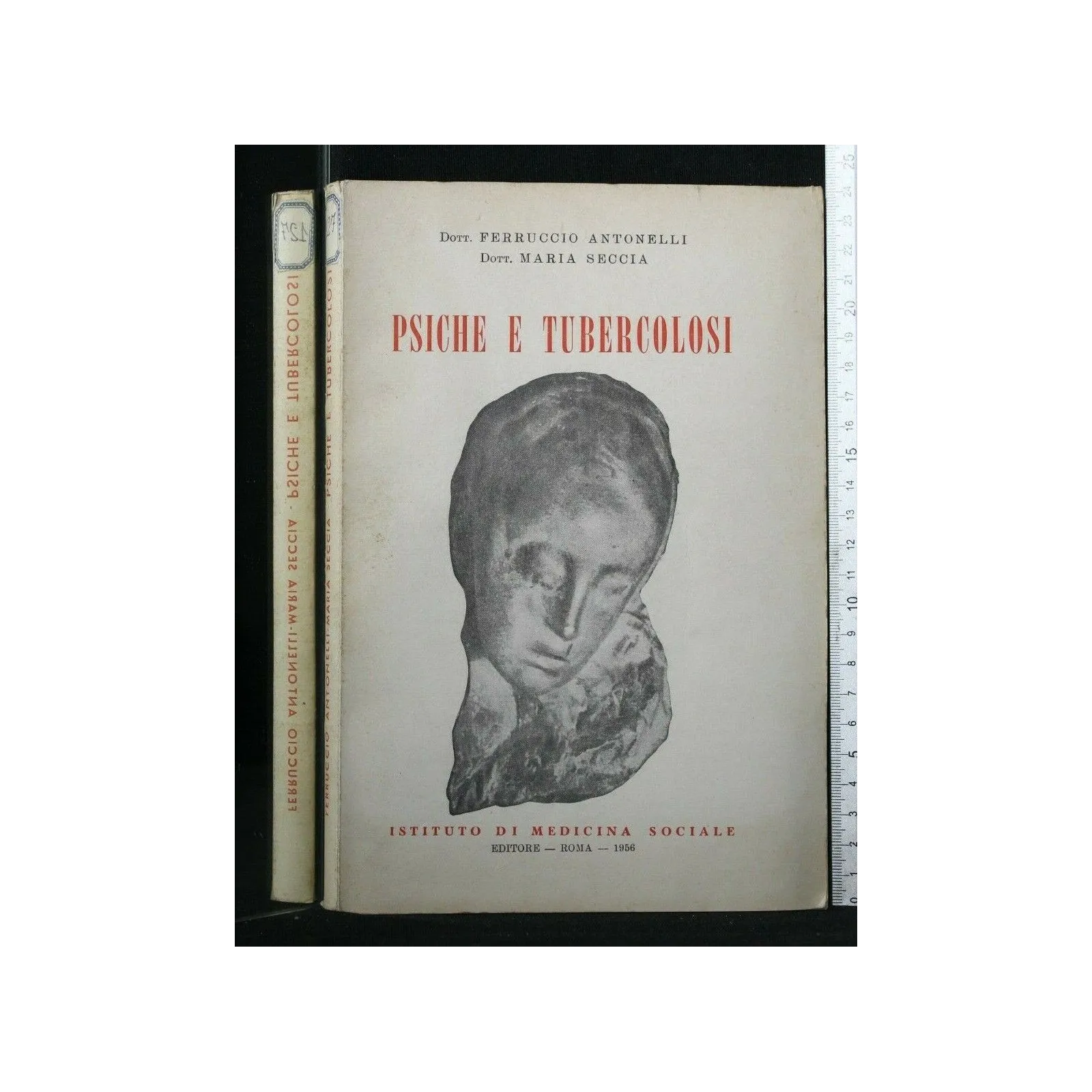 PSICHE E TUBERCOLOSI